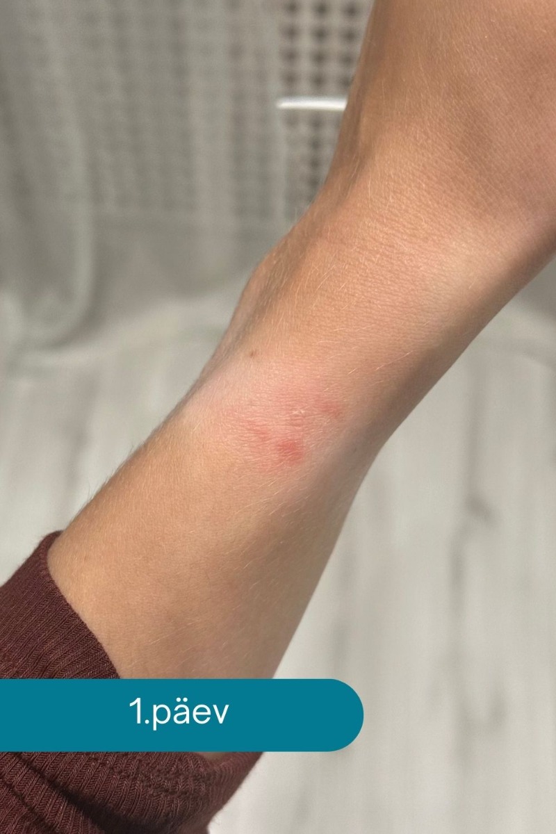 naha_rrituse_leevendamine_Ovelle_Calamin_1_