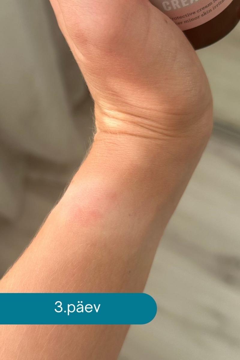 naha_rrituse_leevendamine_Ovelle_Calamin_3_