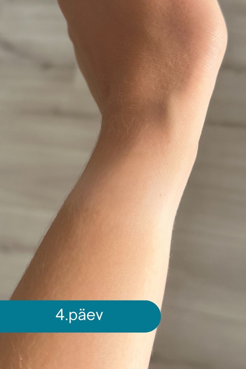 naha_rrituse_leevendamine_Ovelle_Calamin_4_